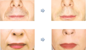 fill3